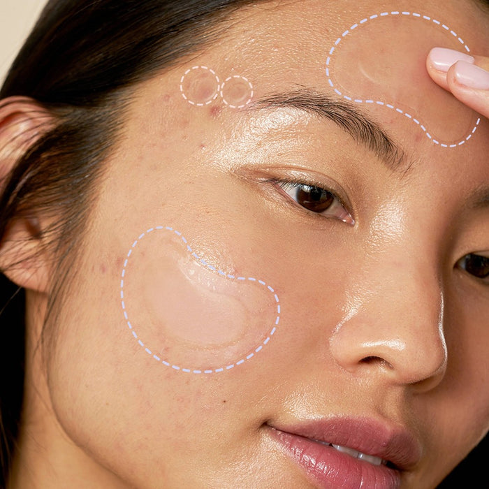 Rael Beauty Miracle Acne Pimple Patch Invisible Spot Cover + Spot Control Cover Duo - 15ct