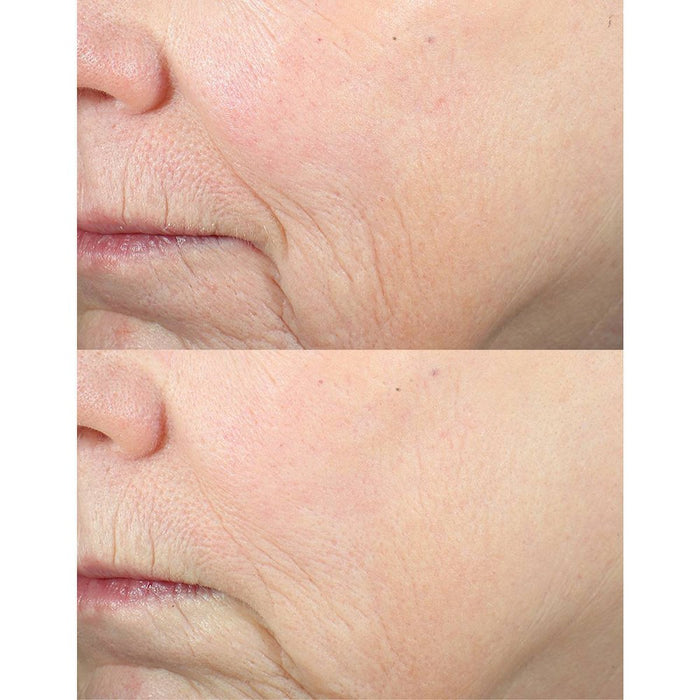 derma e Advanced Peptides & Collagen Eye Cream - 0.5oz