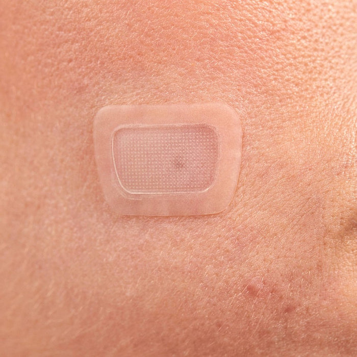 Rael Beauty Miracle Microcrystal Acne Dark Spot Cover Pimple Patch - 6ct