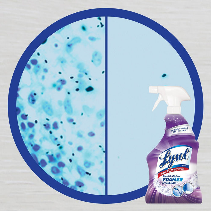 Lysol Mildew Remover Spray with Bleach - 28oz