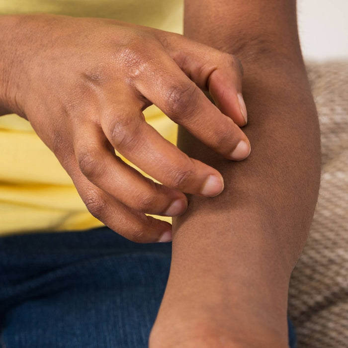 Hydrocortisone 1% Anti-Itch Cream with Soothing Aloe - 4oz - up & up™