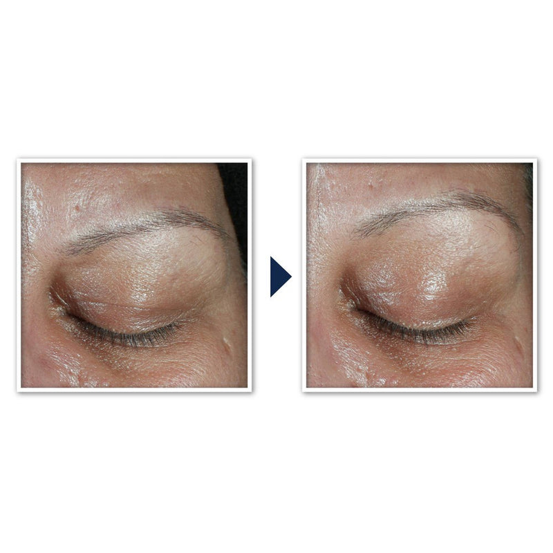 RoC Derm Correxion Dual Eye Cream - 0.68 fl oz