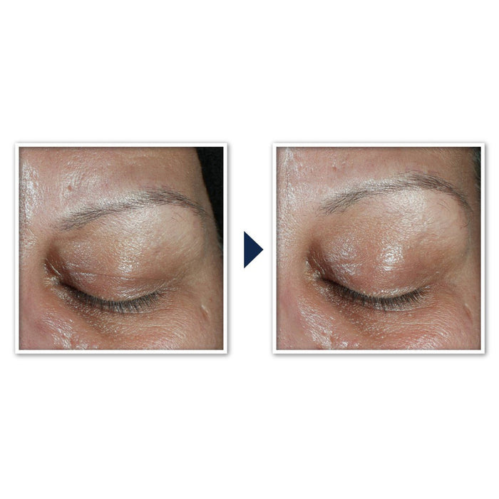 RoC Derm Correxion Dual Eye Cream - 0.68 fl oz