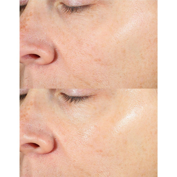 derma e Vitamin C Serum - 2 fl oz