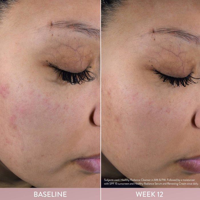 Cetaphil Healthy Radiance Brightening Antioxidant-C Face Serum - 1 fl oz