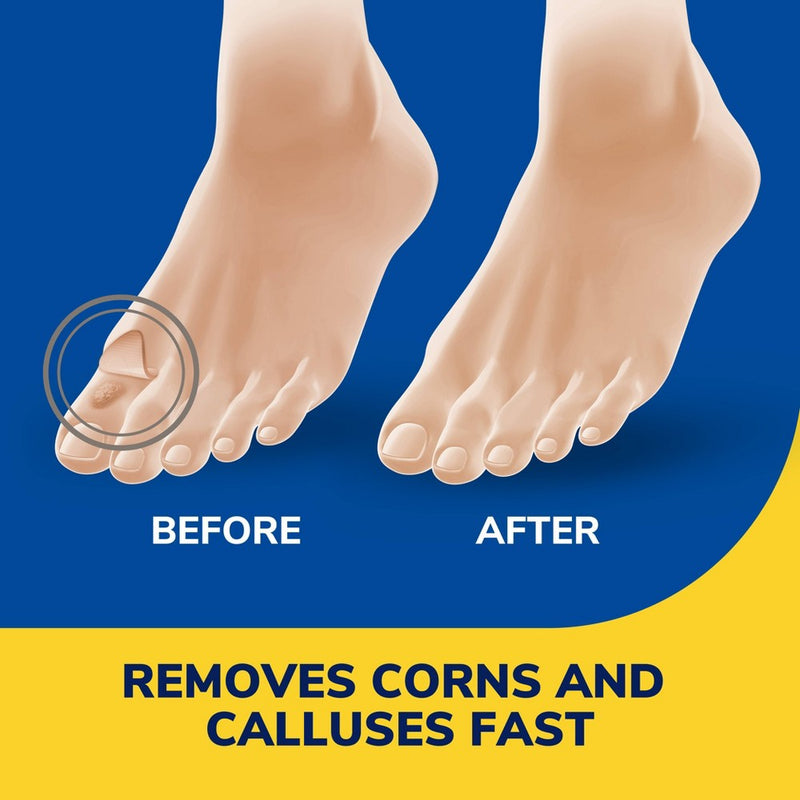 Dr. Scholl's Liquid Corn and Callus Remover - 0.33oz