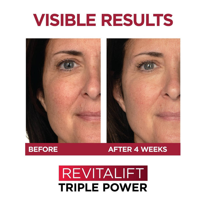 L'Oreal Paris Revitalift Triple Power Deep-Acting Face Moisturizer - 1.7oz