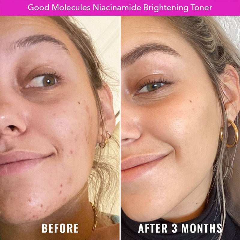 Good Molecules Niacinamide Brightening Face Toner - 1 fl oz