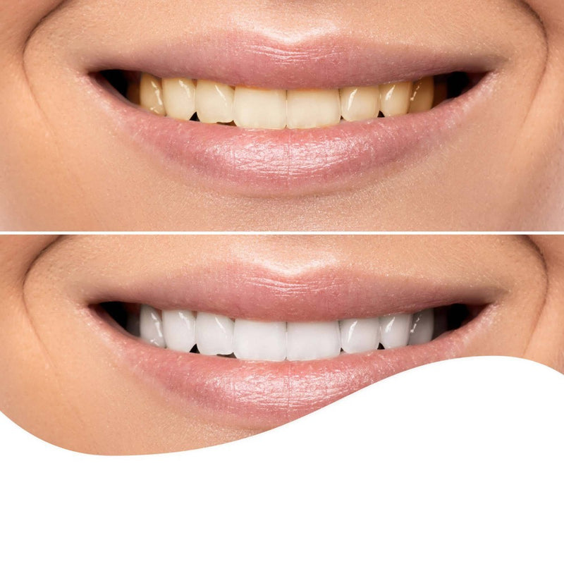 7-Day Quick Whitening Wraps - up & up