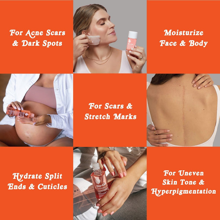 Bio-Oil Skincare Oil For Scars and Stretchmarks, Serum Hydrates Skin, Reduce Appearance Of Scars - 2 fl oz