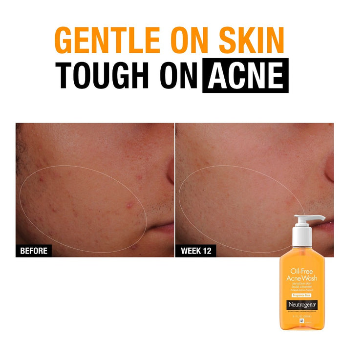 Neutrogena Oil-Free Acne Fighting Face Wash - Fragrance Free - 9.1 fl oz