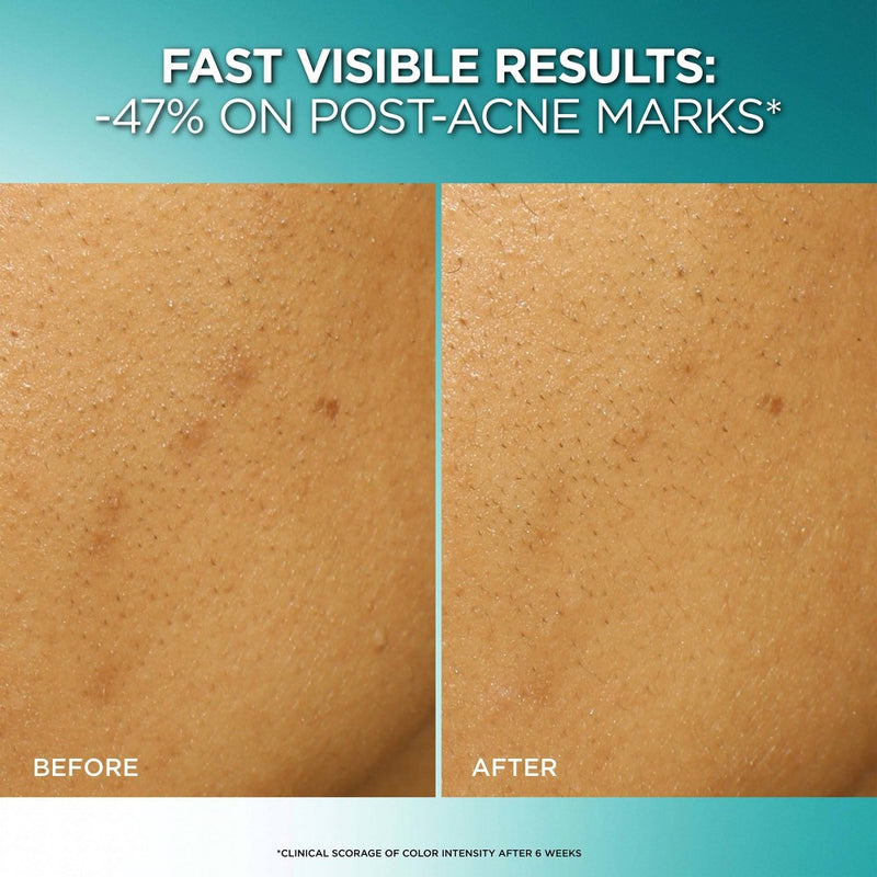 L'Oreal Paris Bright Reveal Dark Spot Exfoliant Peel