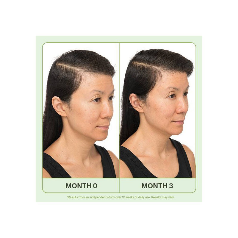 Divi Scalp Serum - 1 fl oz - Ulta Beauty