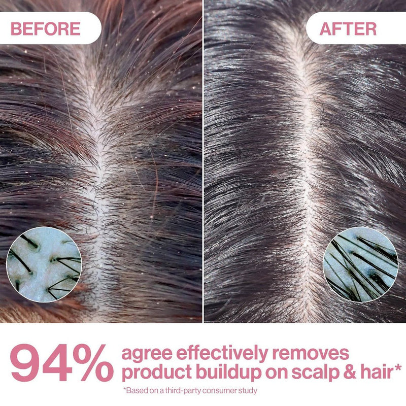 Rizos Curls Apple Cider Vinegar Scalp & Hair Rinse - 10 fl oz