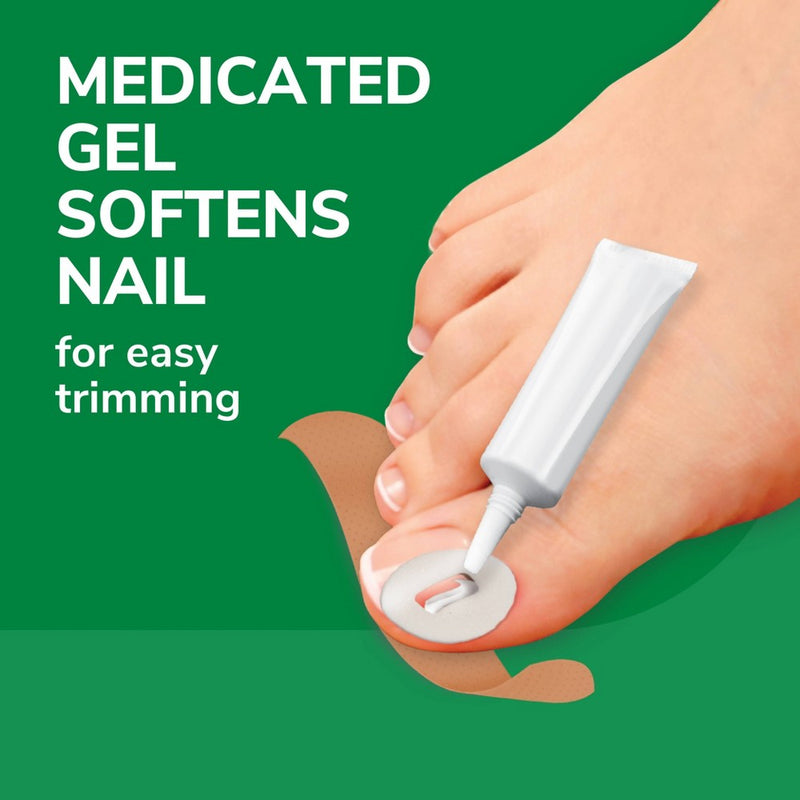 Dr. Scholl's Ingrown Toenail Pain Reliever - 0.3oz