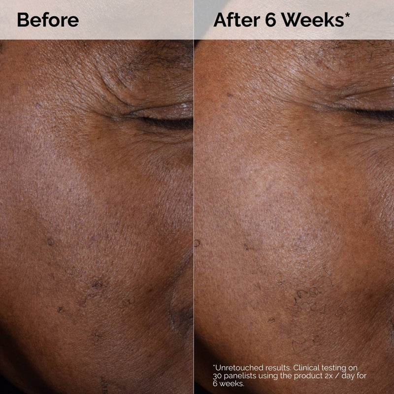 The Ordinary Glycolic Acid 7% Toning Solution - 8 fl oz - Ulta Beauty