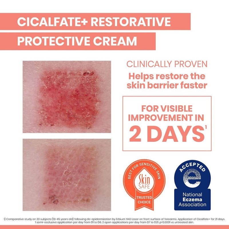 Avene Cicalfate Cream - 3.3 fl oz
