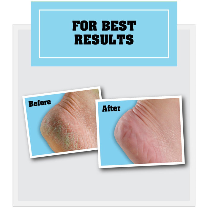O'Keeffe's Healthy Feet Cream - 3oz
