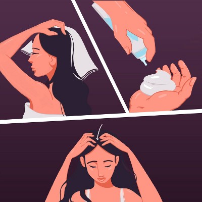 Women's Rogaine 5% Minoxidil Foam for Hair Regrowth - 2 Month Supply