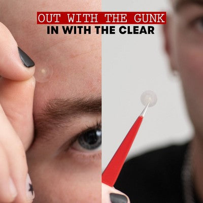 Thayers Natural Remedies Invisible S.O.S Hydrocolloid Ultra-Thin Acne Pimple Patch - 22ct