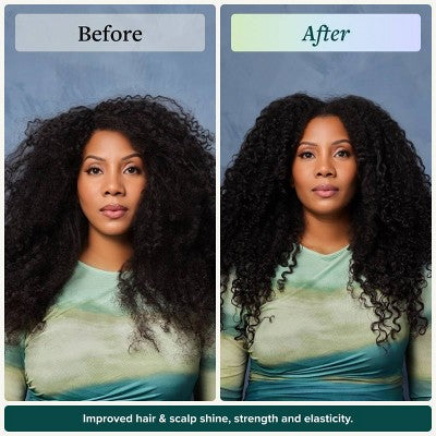 Alodia Nourish and Grow Healthy Hair and Scalp Oil - 8.5 fl oz