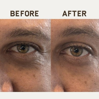 Papatui Ageless Action Technology Under Men's Eye Patch Unscented for Sexy Eyes - 6ct