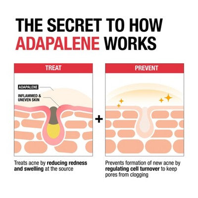 Neutrogena Stubborn Acne Adapalene Gel with 0.1% Adapalene Acne Treatment - 1.6oz