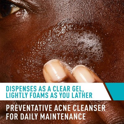 CeraVe Acne Control Face Cleanser - 12 fl oz