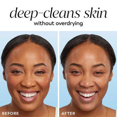 Olay Cleansing Melts Gentle Fragrance Free Face Cleanser - 32ct