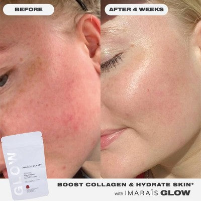 Imarais Beauty Glow Skincare Gummies for Hydration, Collagen Boosting - Vegan and Sugar-Free - 30ct