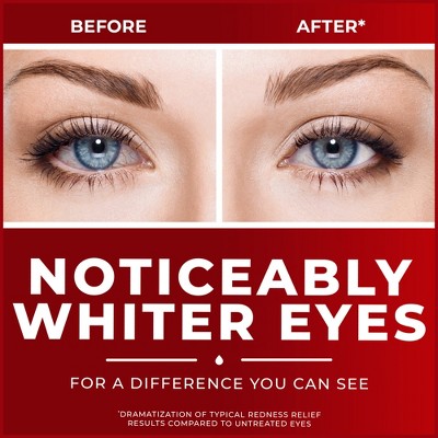 Clear Eyes Maximum Strength Eye Drops for Redness Relief, Dryness, Burning, & Irritation - 0.5 fl oz