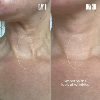 MAELYS B-Poised Neck and Decollete Cream - Ulta Beauty