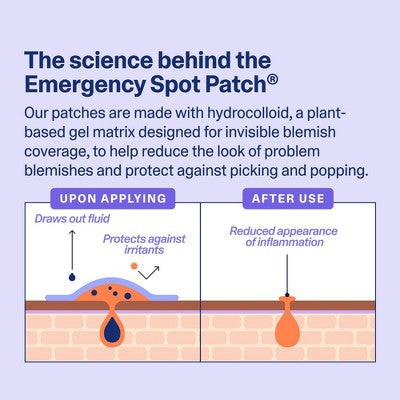Curology Emergency Spot Facial Pimple Patches - 80ct: Acne Treatment, Vegan, For Normal, Oily, Combination, Sensitive Skin