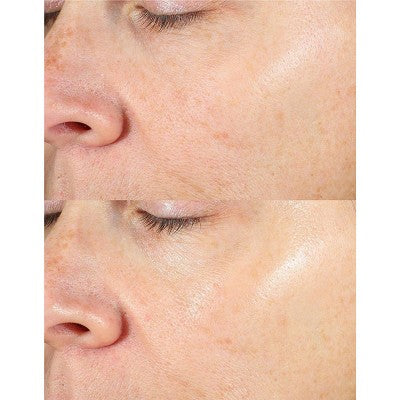 derma e Vitamin C Instant Radiance Citrus Facial Peel - 2oz