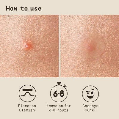 Papatui Men's Pimple Patch with Hydrocolloid Technology Dermatologist Tested - 36ct: Non-Toxic, Unscented, Normal and Acne-Prone Skin