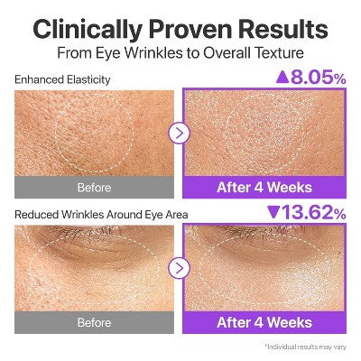 numbuzin No.9 NAD+Bio Lifting-sil Essence - 1.01floz: Skin Tone Improvement, Plumping, Firming