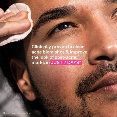 StriVectin Multi-Action Clear Acne Control System - Ulta Beauty: For Combination, Acne-Prone Skin, Includes Cleanser, Toner, Lotion