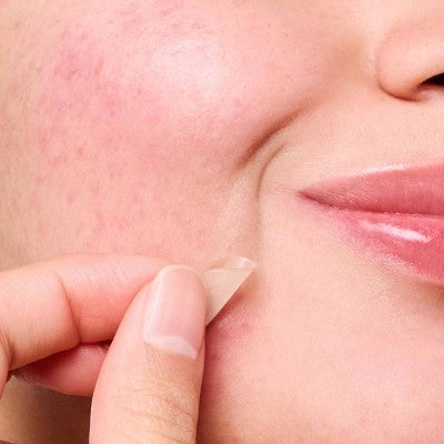 Hero Mighty Patch Micropoint for Blemishes - 8ct