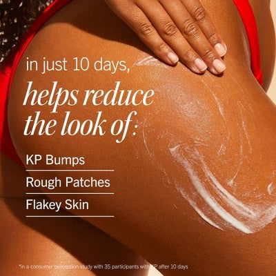 FIRST AID BEAUTY KP Smoothing + Brightening Body Lotion with 10% AHA + Urea - 6.7 fl oz - Ulta Beauty