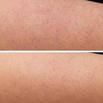 Strivectin KP Care Texture Smoothing Body Cream - 6.7 oz - Ulta Beauty: Normal Skin, Whole Body, Scented