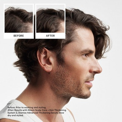 Nioxin System 2 Hair Thickening Natural & Untreated Hair Shampoo & Conditioner Kit - 3ct