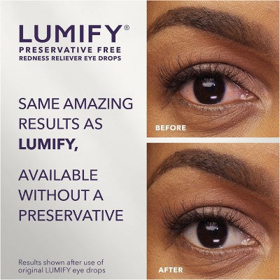 Lumify Eye Drops for Redness Relief - Preservative Free Vials - 20ct