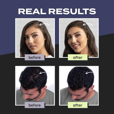 Toppik Hair Building Fibers, Fill In Fine or Thinning Hair Instantly Thicker, Fuller Looking Hair , Black .97 OZ