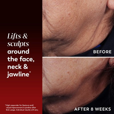 Olay Regenerist Lifting & Sculpting Face, Neck, Decollete Treatment, Triple Collagen Peptide with NAD+ - Fragrance-Free - 1.7 fl oz