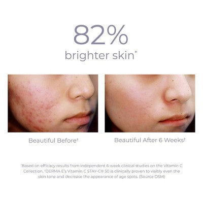 derma e Vitamin C Instant Radiance Citrus Facial Peel - 2oz
