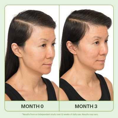 Divi Mini Scalp Serum - 0.5 fl oz - Ulta Beauty: Nourishing Treatment for All Hair Types, Hair Regrowth & Thickening
