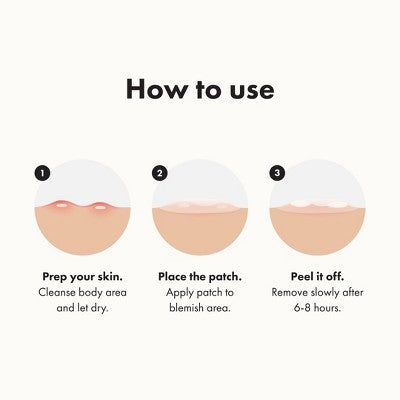 Hero Cosmetics Mighty Patch Body Patch - 4ct: Alcohol-Free, Whole Body Application, Acne-Prone Skin