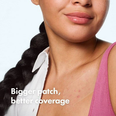 Hero Cosmetics Mighty Patch Body Patch - 4ct: Alcohol-Free, Whole Body Application, Acne-Prone Skin