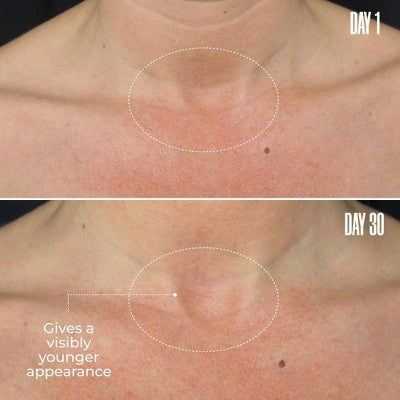 MAELYS B-Poised Neck and Decollete Cream - Ulta Beauty