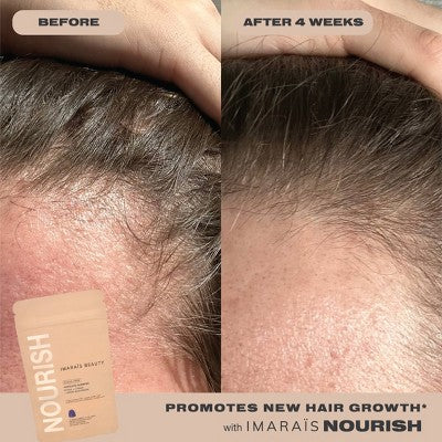 Imarais Beauty Nourish Haircare Gummies for Hair Growth, Anti-Shedding - Vegan and Sugar-Free - 30ct